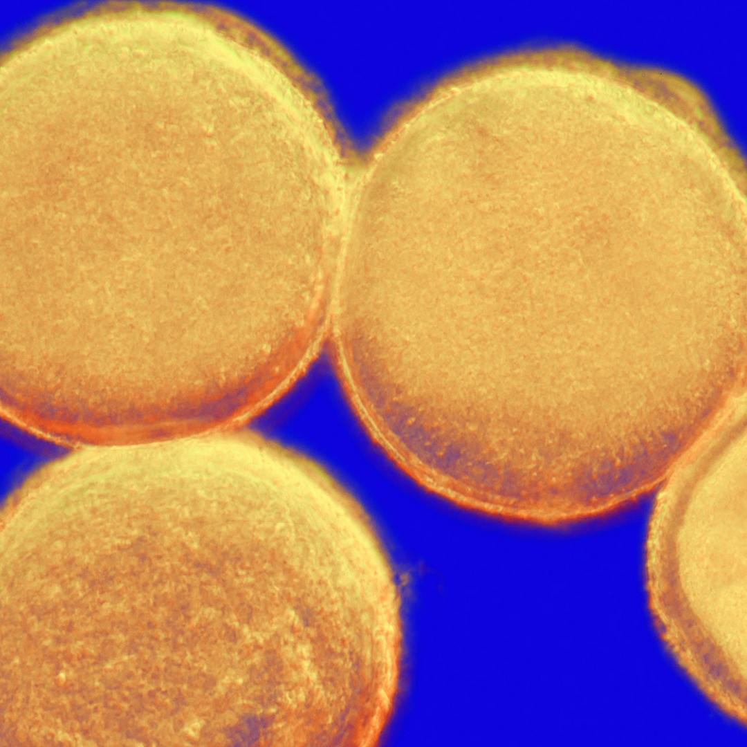 Microscope-style image of round golden cells against a blue background