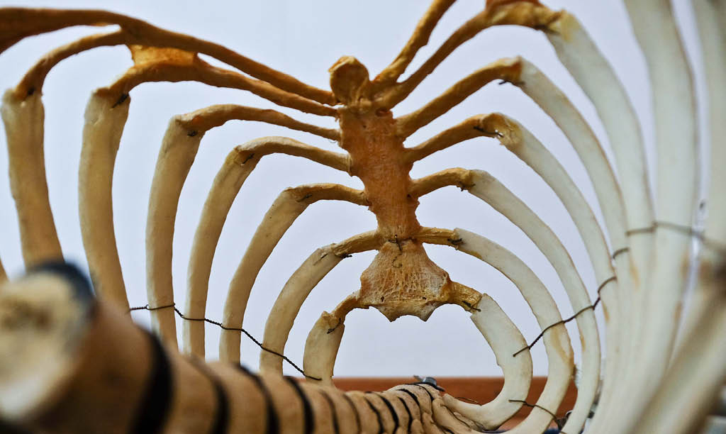 What is Osteoporosis?