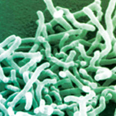 bifidobacterium-longum